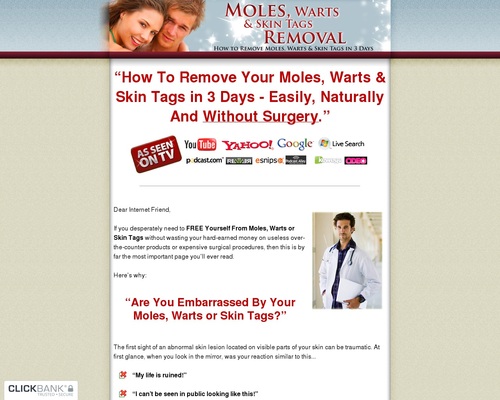 Moles, Warts & Skin Tags Removal – How To Safely & Permanently Remove Moles, Warts & Skin Tags