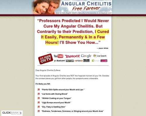 Angular Cheilitis Free Forever – How to Cure Angular Cheilitis Naturally & Permanently in 12 Hours or Less