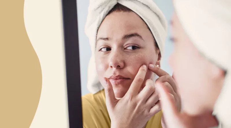 Why You Need Serious Skin Care Acne to Clear Up Your Skin