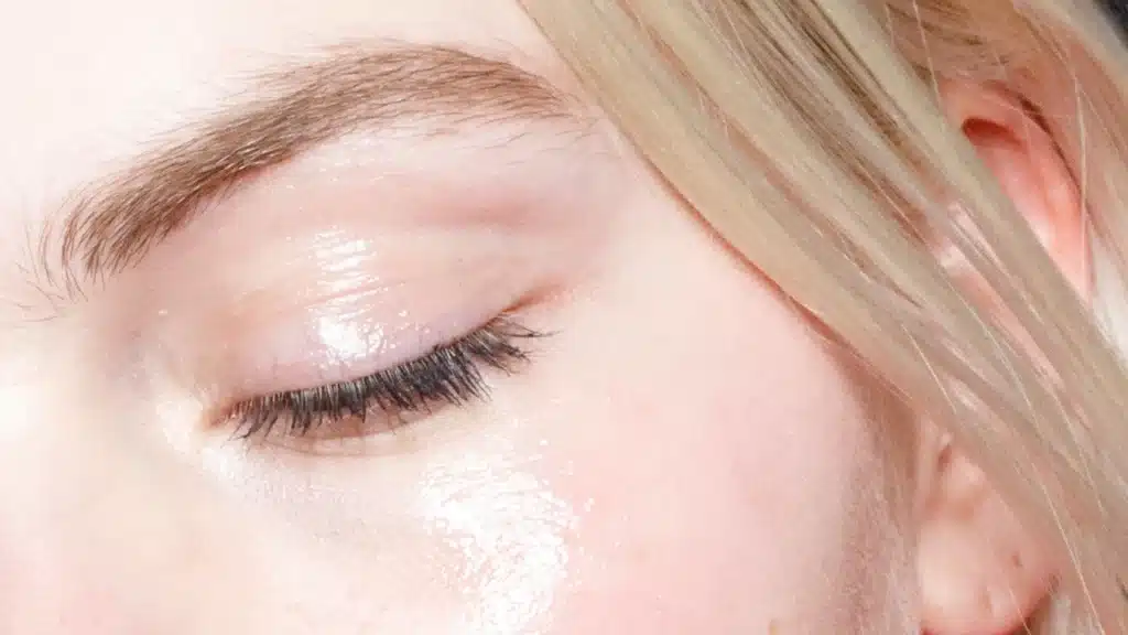 Best Natural Treatment For Scars From Acne Best Natural Treatment For Scars From Acne